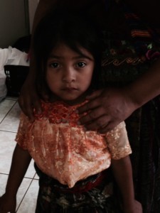 Adorable Guatemalan children who received treatment